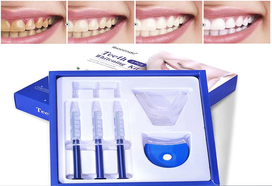 Know About Teeth Whitening Kits