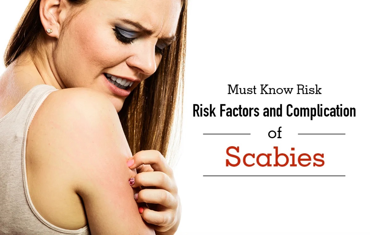 Who's at Risk of Scabies?