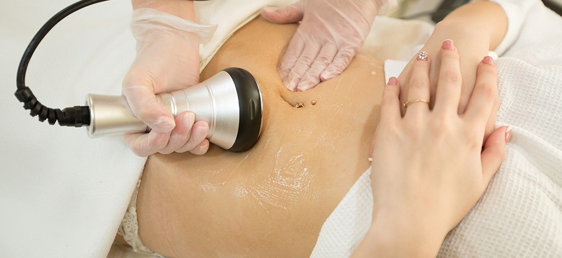 Cavitation Therapy for Targeted Areas